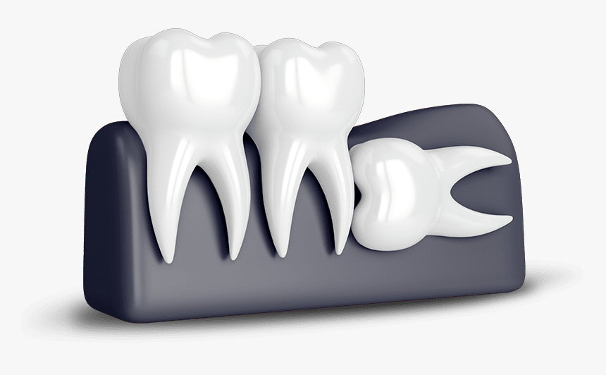 Wisdom Tooth Extraction - Tooth Wisdom, HD Png Download, Free Download