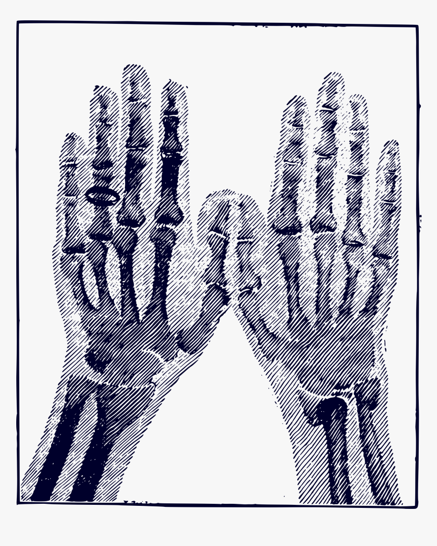 X-ray Image Clip Arts - Hand Bones .png, Transparent Png, Free Download