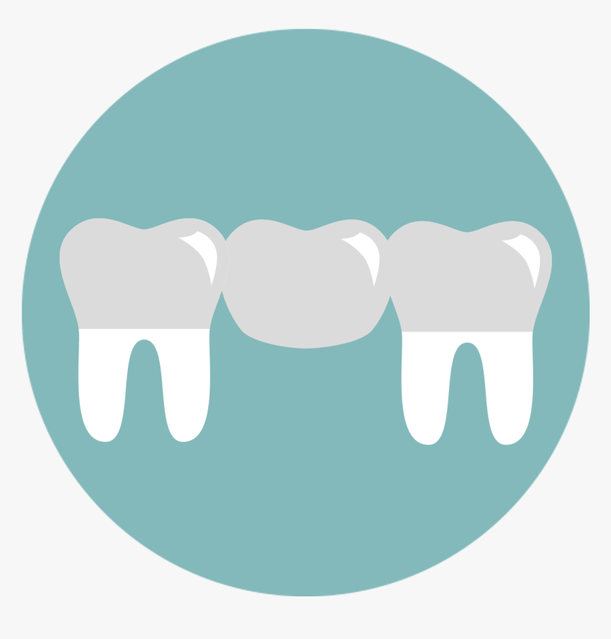 Teeth Clip Round Plastic - Replace Missing Teeth Icons, HD Png Download, Free Download