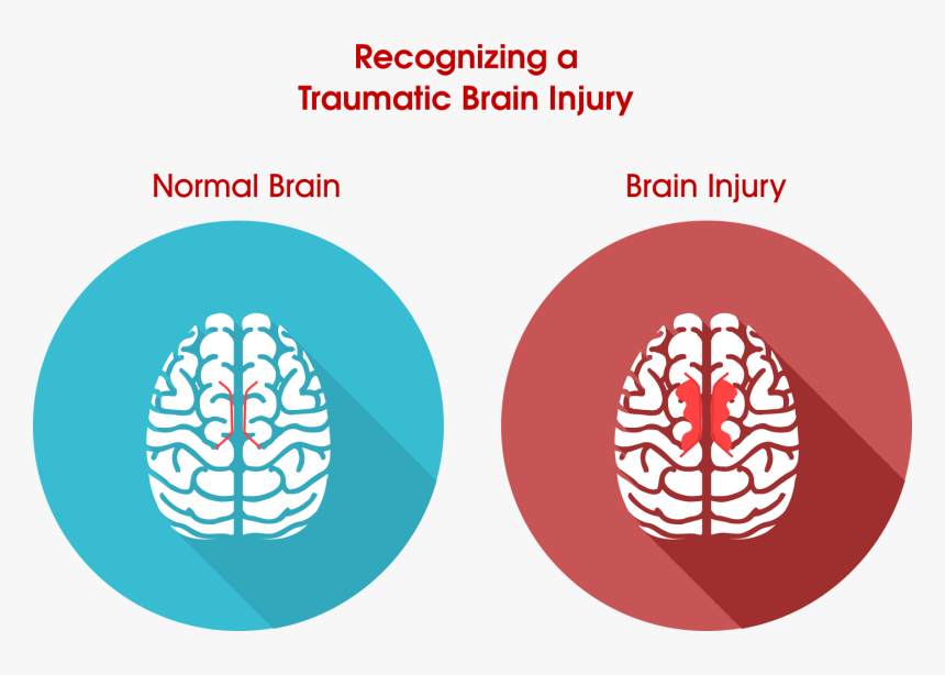 Traumatic Brain Injury Png, Transparent Png, Free Download