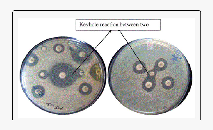 Keyhole Antibiotic, HD Png Download, Free Download