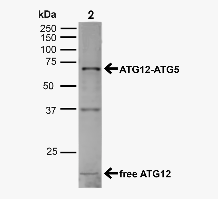 Western Blot - Parallel, HD Png Download, Free Download