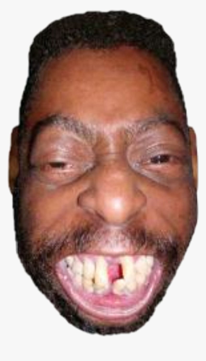 Black People With Messed Up Teeth, HD Png Download, Free Download