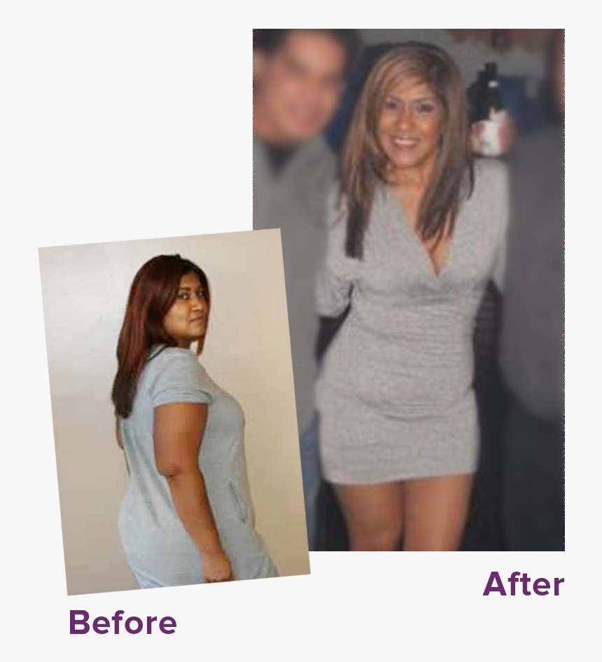 “carmen Took Drop Slim Plus And Detox Trio To Get These - Detox Trio Before After, HD Png Download, Free Download