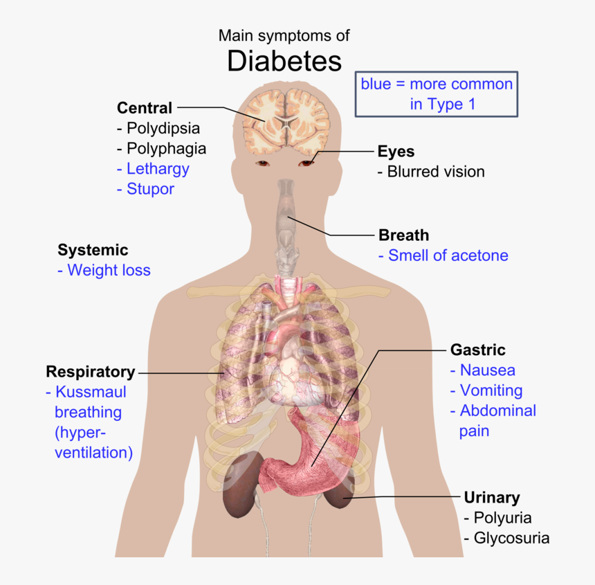 Disease In Organ System, HD Png Download, Free Download