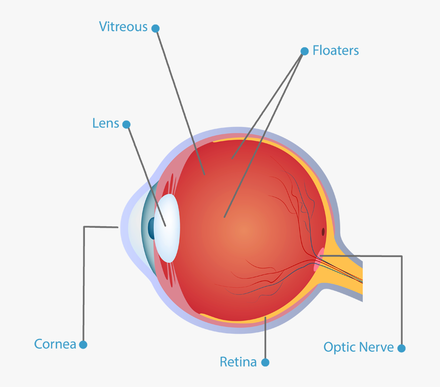 Eye Floaters - Astigmatismo Irregular E Regular, HD Png Download, Free Download