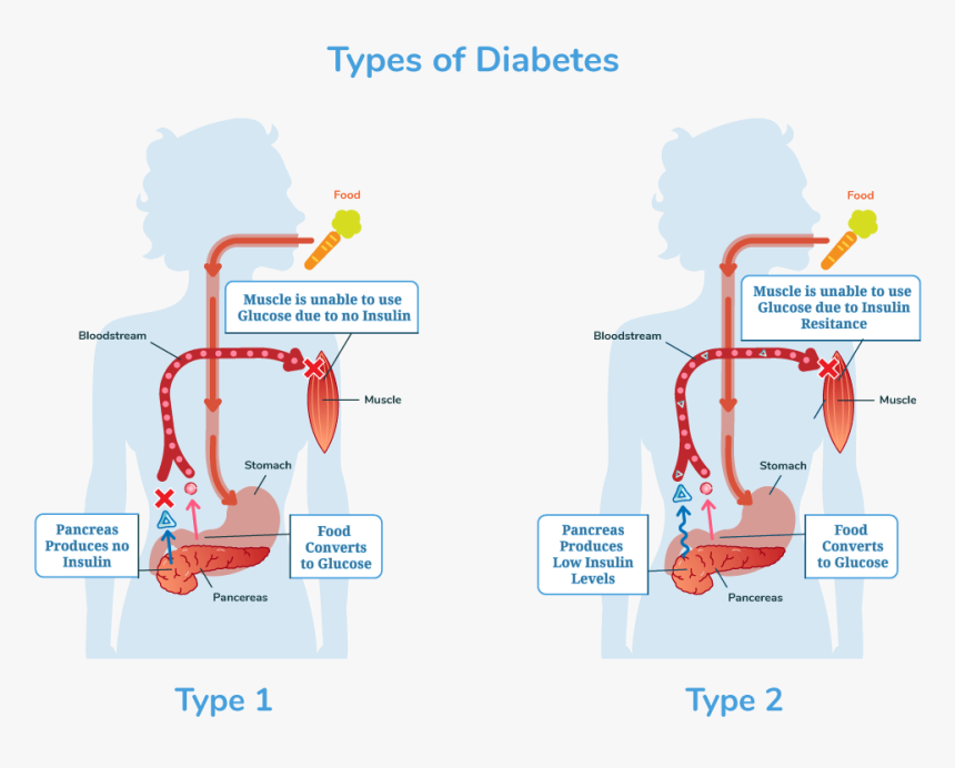 Diabetes Scheme, HD Png Download, Free Download