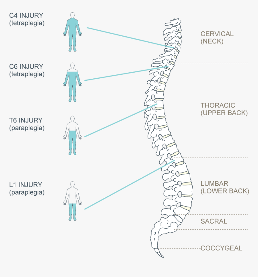 Diagram, HD Png Download, Free Download