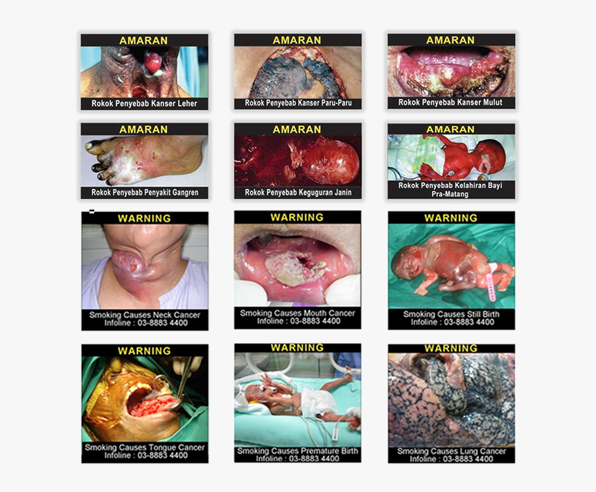 12 Pictorial Health Warning Images - Cigarettes Pictures In Malaysia, HD Png Download, Free Download