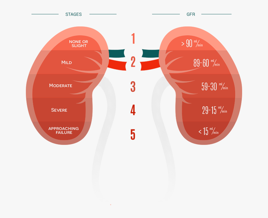 Kidney Failure Png - Causes Of Kidney Failure 2018, Transparent Png, Free Download