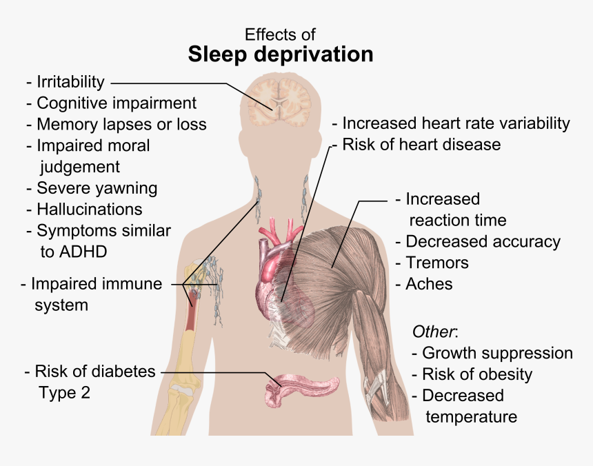 Effects Of Sleep Deprivation, HD Png Download, Free Download