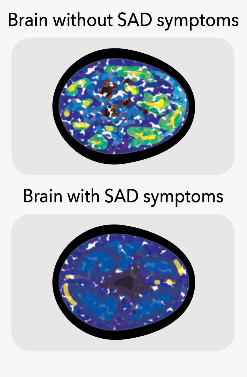 103119 Hs Seasonal Affective R Whelan - Circle, HD Png Download, Free Download