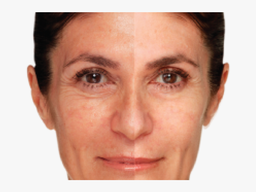 Reduce Wrinkles, HD Png Download, Free Download