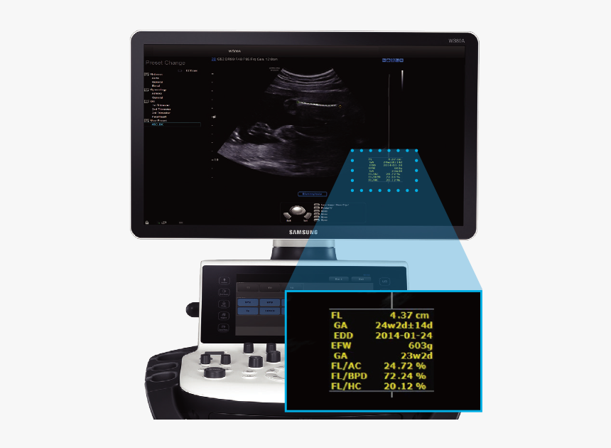 Hycosy In Ceus - Samsung Ws80a Ultrasound Machine, HD Png Download, Free Download