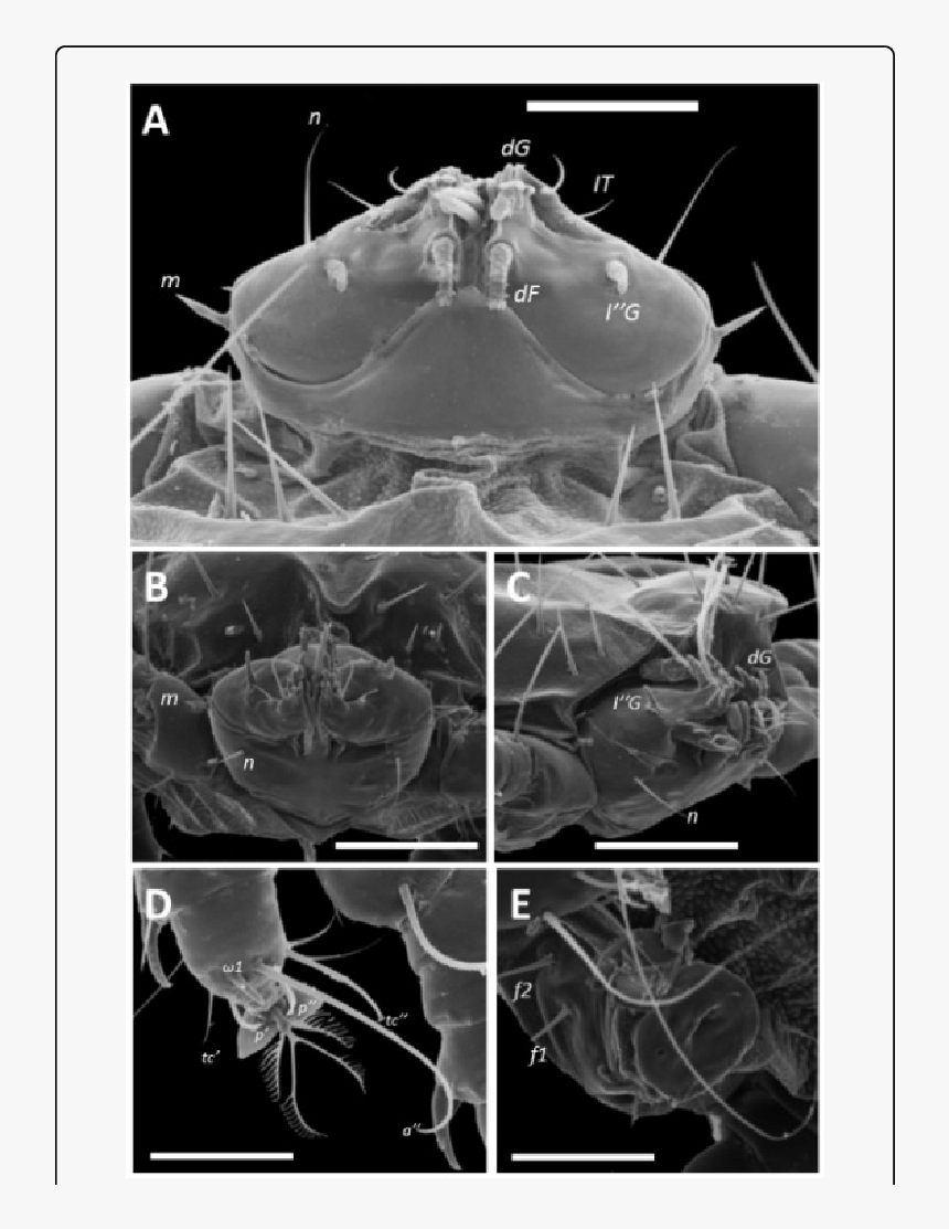 Computed Tomography, HD Png Download, Free Download