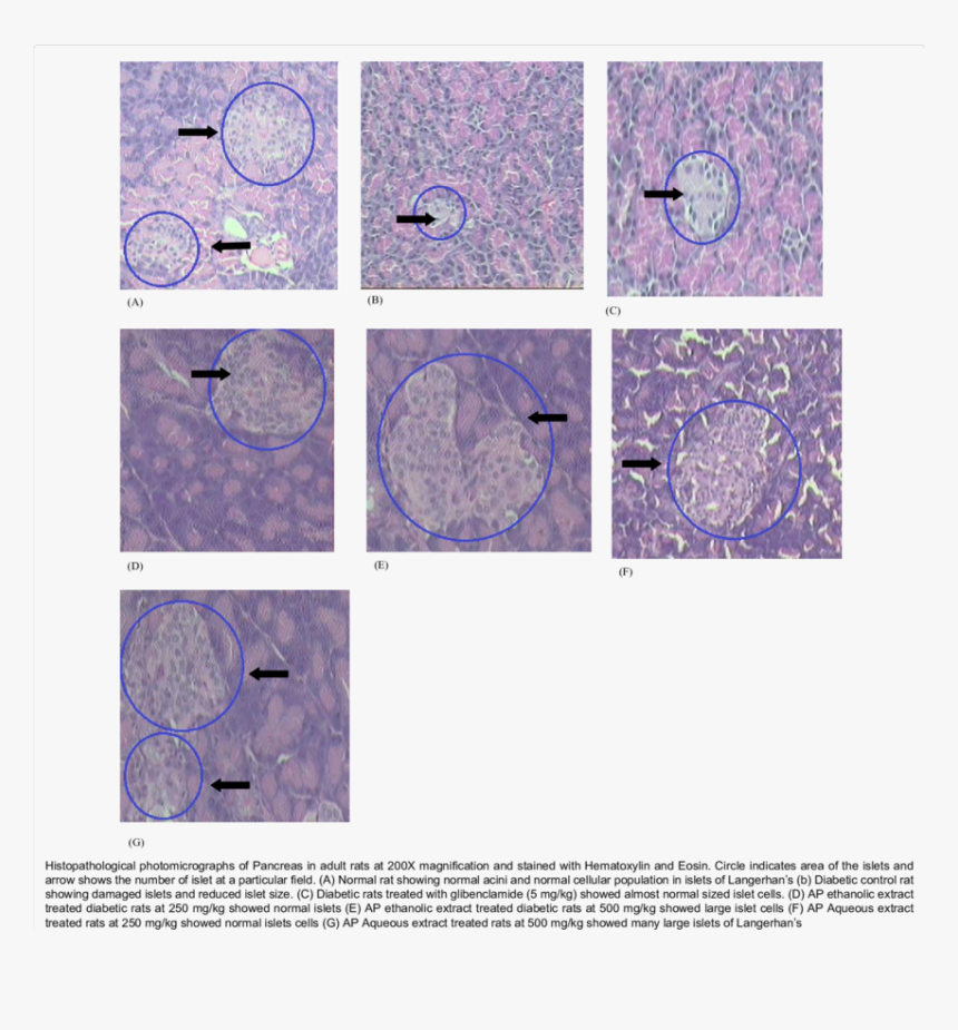 Pancreas Png, Transparent Png, Free Download