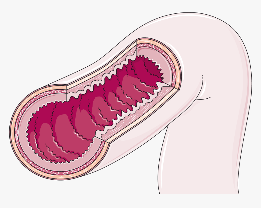 Small Intestine With Villi Clipart, HD Png Download, Free Download