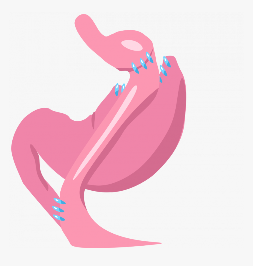 Gastric Bypass, HD Png Download, Free Download
