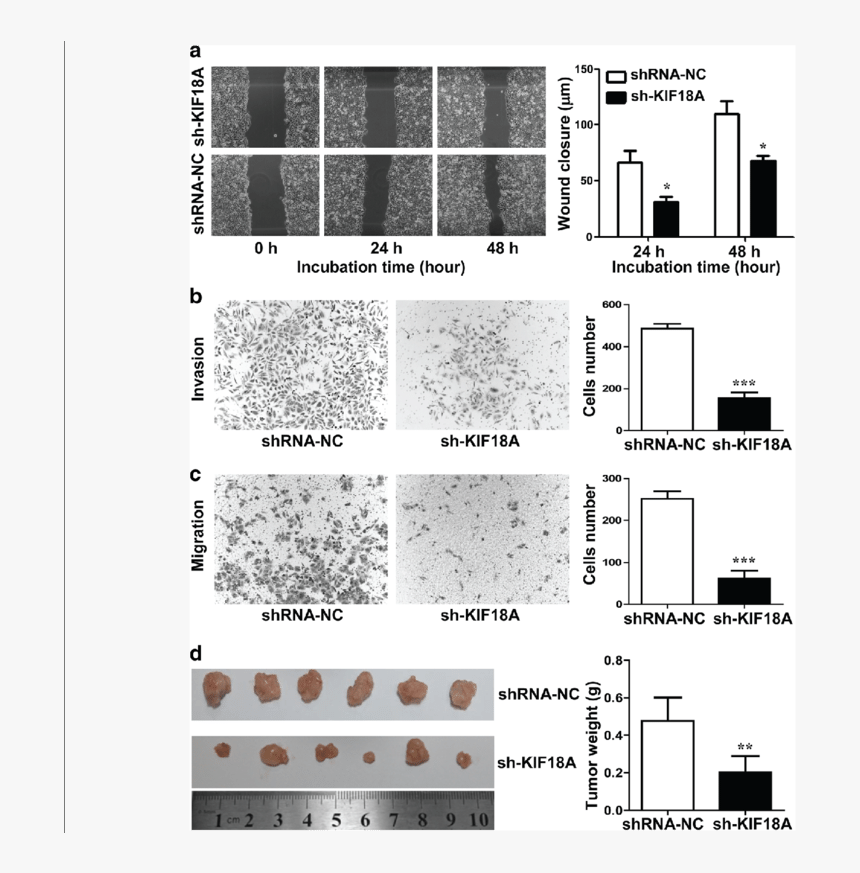 A Cell Scratch Test Result Of Hepg2 Cells Transfected - Colorfulness, HD Png Download, Free Download