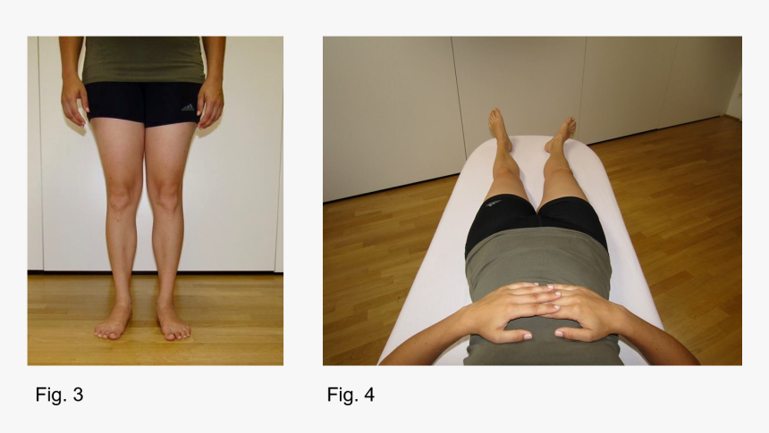 Fig 3 Fig - Externally Rotated Femur Symptoms, HD Png Download, Free Download