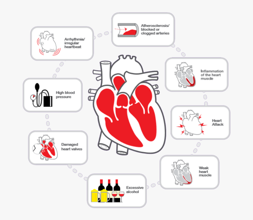 Heart Failure - Parallel, HD Png Download, Free Download