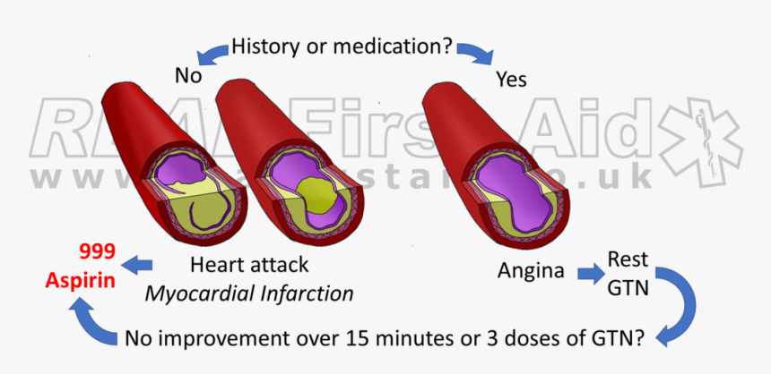 Chest Pain Treatment 2 Logo - Heart Attack And Aspirin, HD Png Download, Free Download