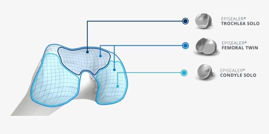 Episealer Placement 1, HD Png Download, Free Download