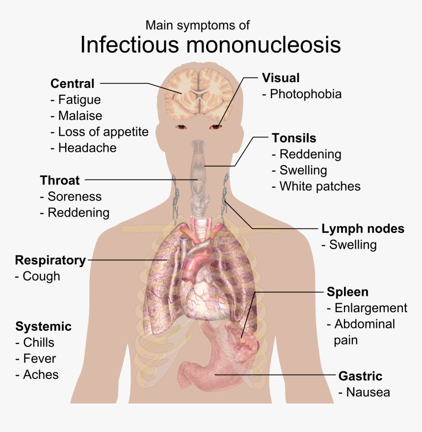 Main Symptoms Of Infectious Mononucleosis, HD Png Download, Free Download