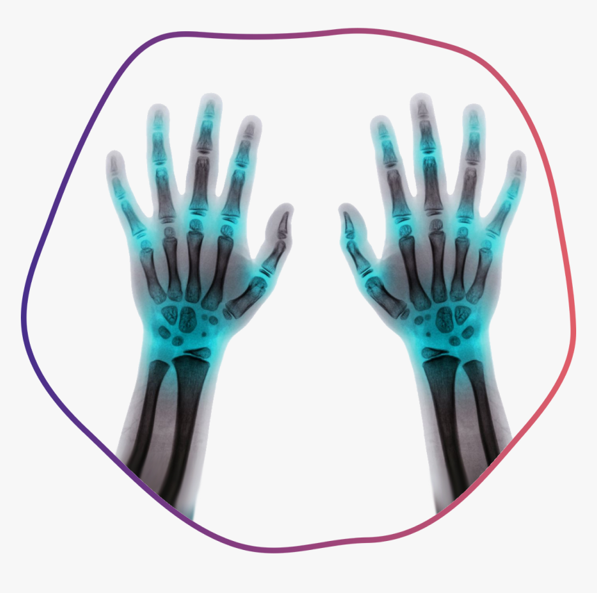 Fingers - X-ray, HD Png Download, Free Download