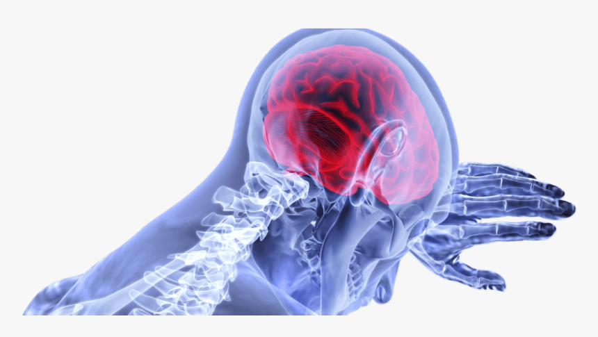 Brain Injury - All You Need To Know About Brain Cancer, HD Png Download, Free Download