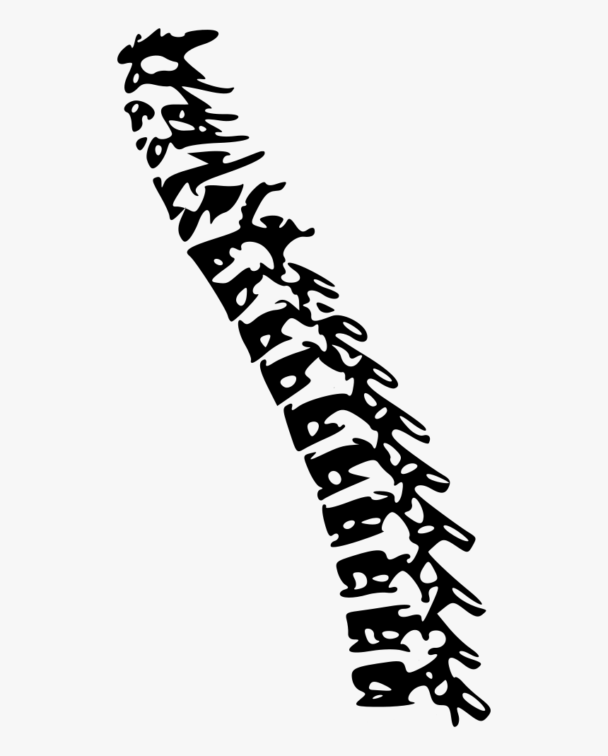 Surgery Drawing Spine - Spine Surgery Clipart, HD Png Download, Free Download