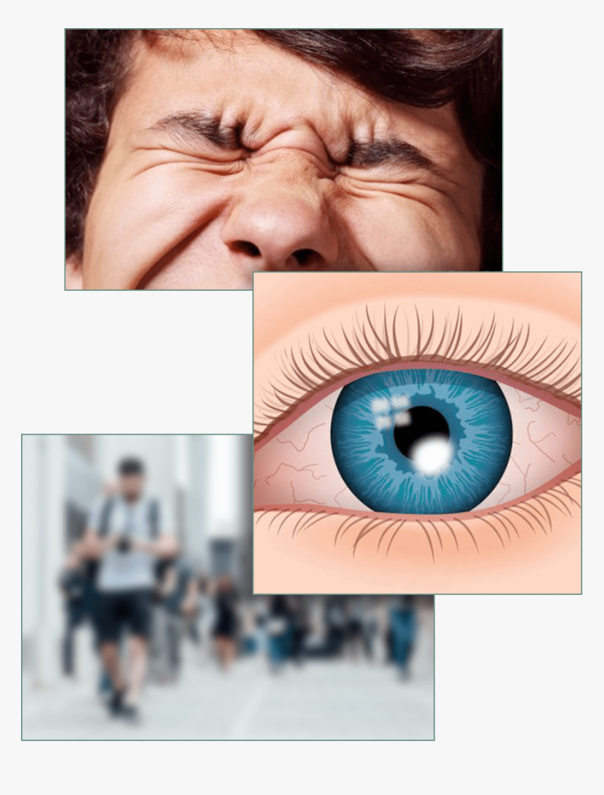 Eye Infection Contact Lenses, HD Png Download, Free Download