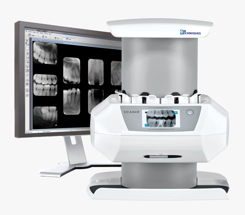 Scanx Intraoral View, HD Png Download, Free Download