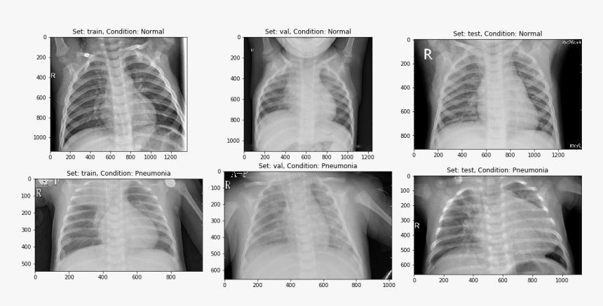 Medical Radiography, HD Png Download, Free Download