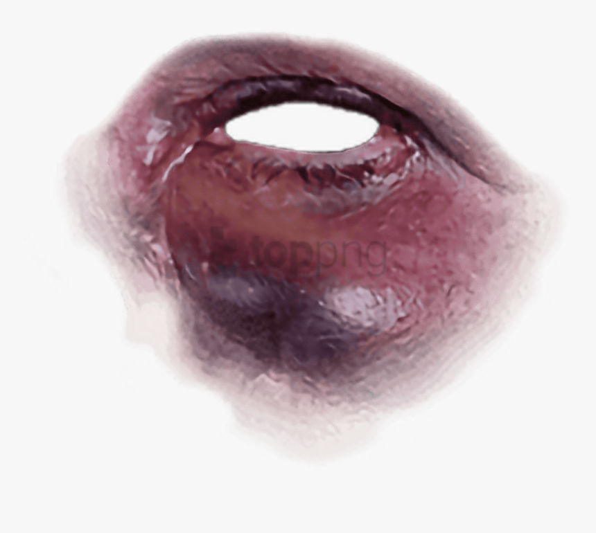 Black Eye Freetoedit - Bruise Black Eye Transparent, HD Png Download, Free Download
