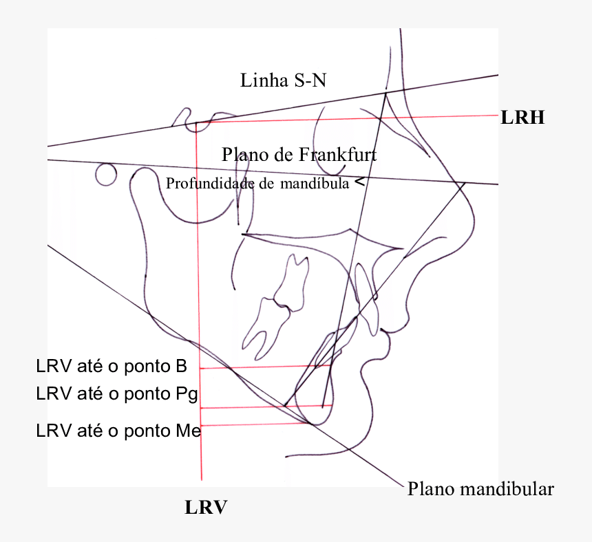 Diagram, HD Png Download, Free Download