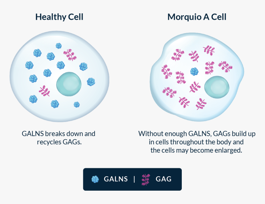 Healthy Cell With A Regular Amount Of Gags - Morquio Syndrome Cell, HD Png Download, Free Download