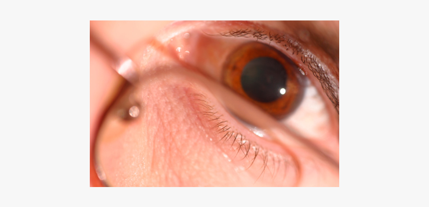 Pupil Dilation - Close-up, HD Png Download, Free Download