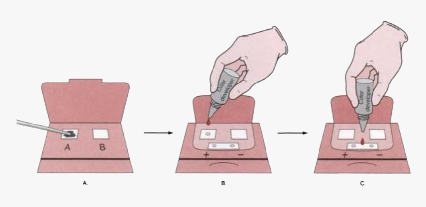 Fecal Occult Blood Test - Digital Rectal Examination Colorectal Cancer, HD Png Download, Free Download