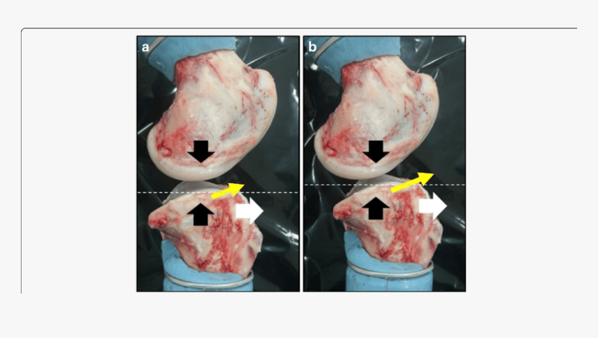 Porcine Lateral Collateral Ligament, HD Png Download, Free Download