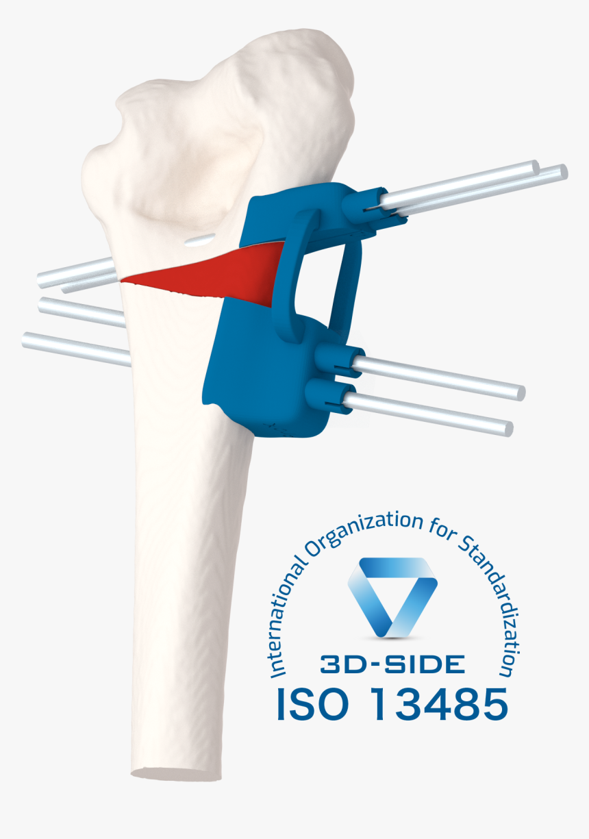 Corrective Osteotomy - Fictional Character, HD Png Download, Free Download