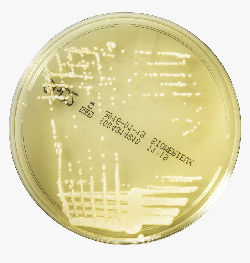 Petri Dish Png, Transparent Png, Free Download