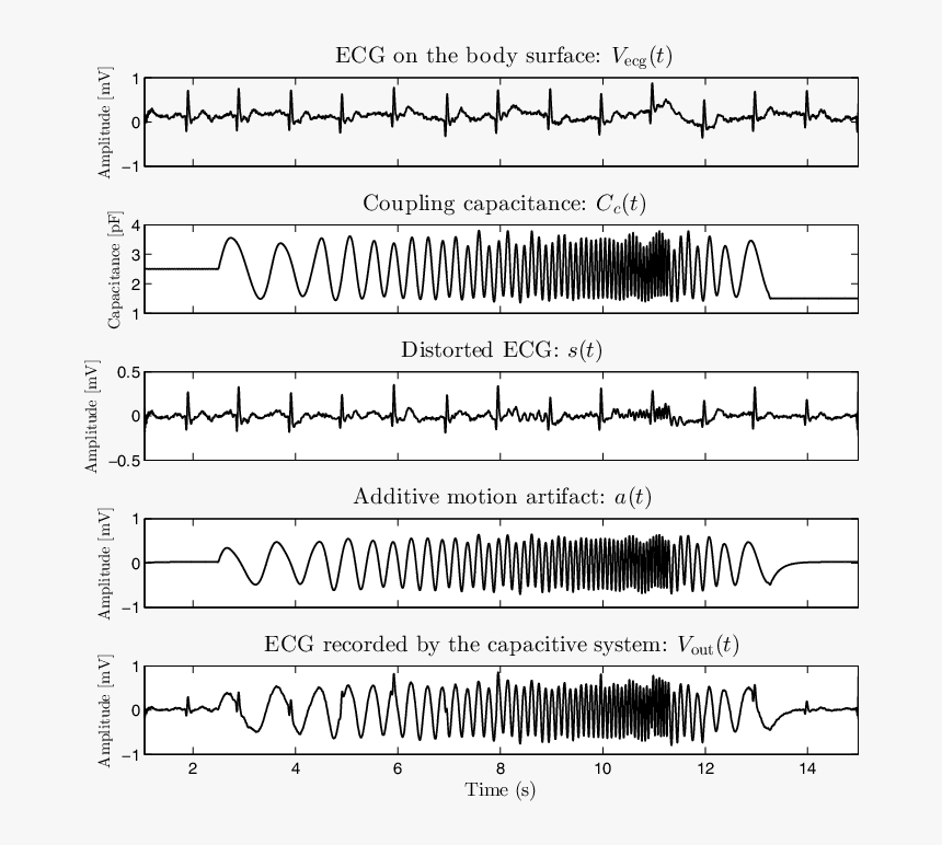 Motion Artifact Ecg, HD Png Download, Free Download