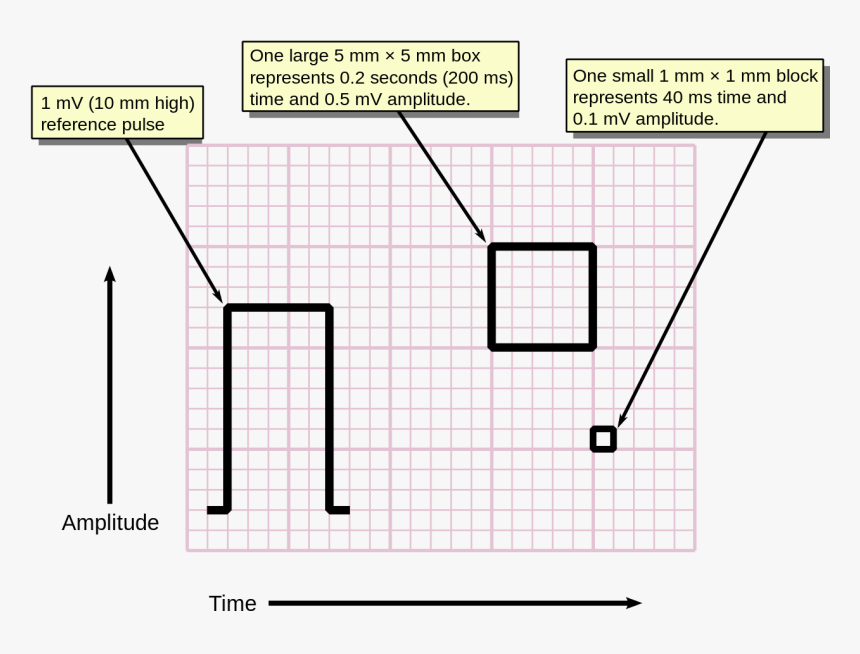 Ecg Graph Paper, HD Png Download, Free Download