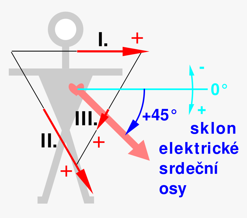 Ecg Einthoven Vect6 Sklon Osy45 - Triangle D Einthoven, HD Png Download, Free Download