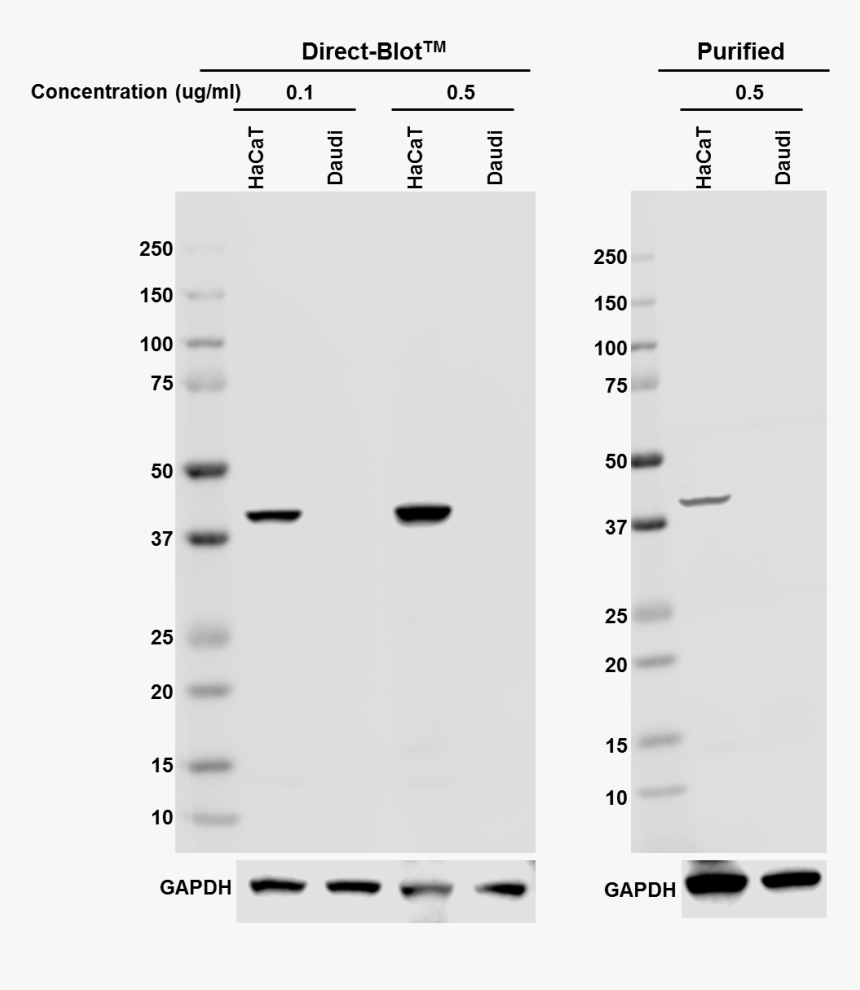 A53-bslasha2 Hrp Cytokeratin19 Antibody - Monochrome, HD Png Download, Free Download