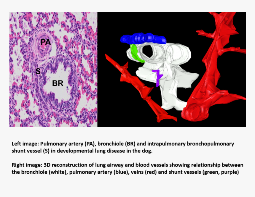 Canine Lung Disease - Illustration, HD Png Download, Free Download