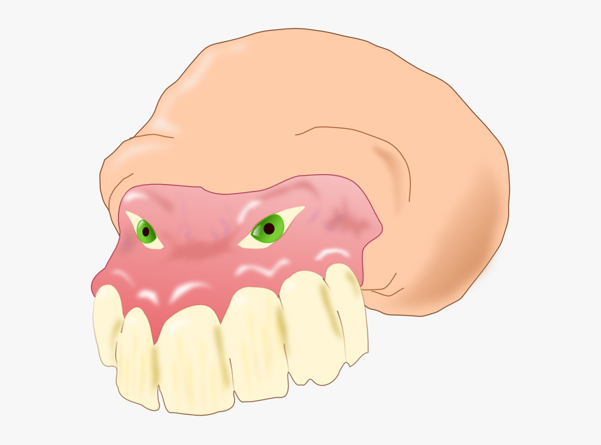 Bulimia - Clipart - Dentistry, HD Png Download, Free Download