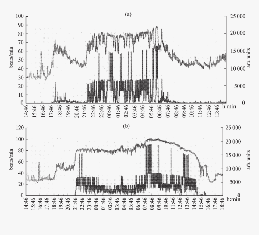 Examples Of The Crayfish Cardioactivity At Action Of - Sketch, HD Png Download, Free Download