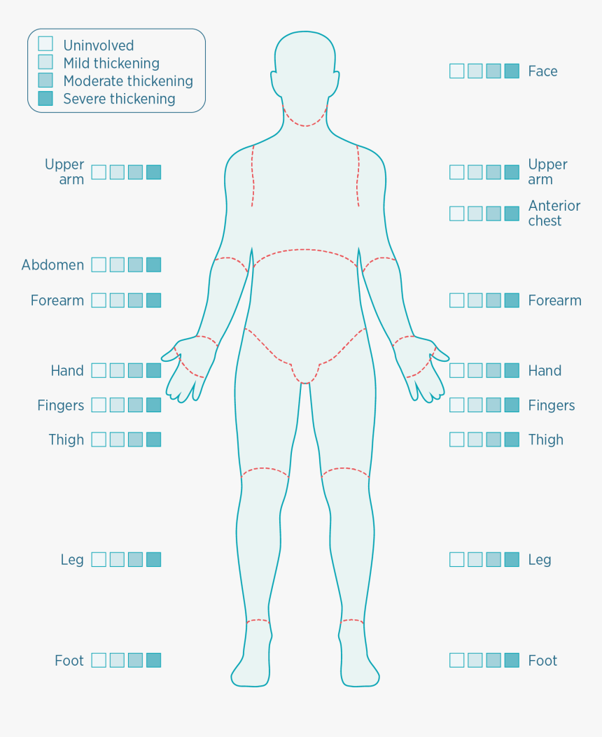 Thickness Of Skin Body Diagram, HD Png Download, Free Download